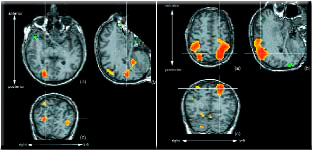 ¿CÓMO FUNCIONAN LOS HEMISFERIOS CEREBRALES